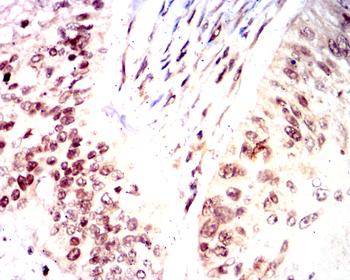 NME1 Antibody