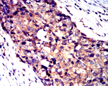 NME1 Antibody