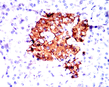 INS Antibody