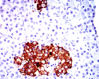 INS Antibody
