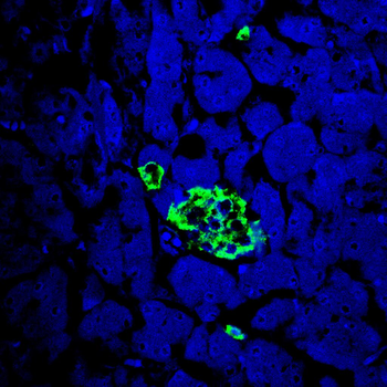 INS Antibody