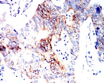 ALDH2 Antibody