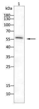 ALDH2 Antibody