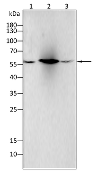 ALDH2 Antibody