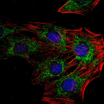 ALDH2 Antibody