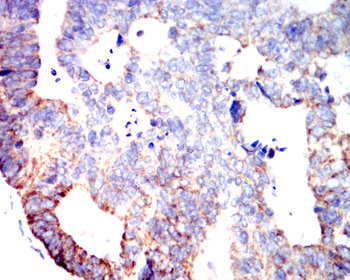 ALDH2 Antibody
