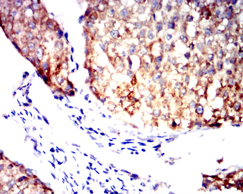 ALDH2 Antibody