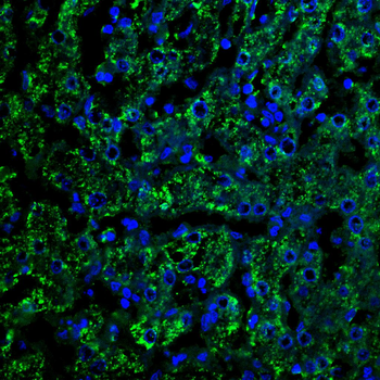 ALDH2 Antibody