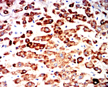 ALDH2 Antibody