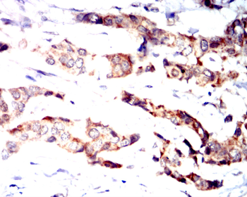 PIEZO1 Antibody