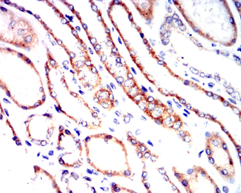 PIEZO1 Antibody