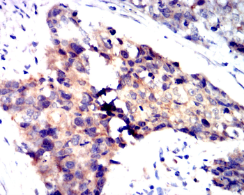PIEZO1 Antibody