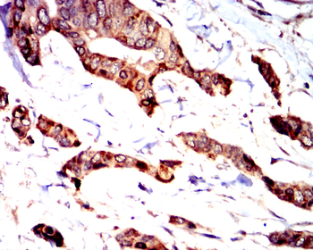 HAVCR2 Antibody