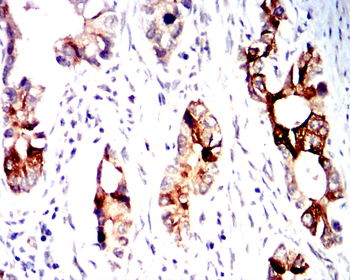 HAVCR2 Antibody