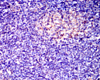 HAVCR2 Antibody