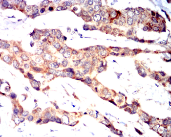 TNFRSF11B Antibody