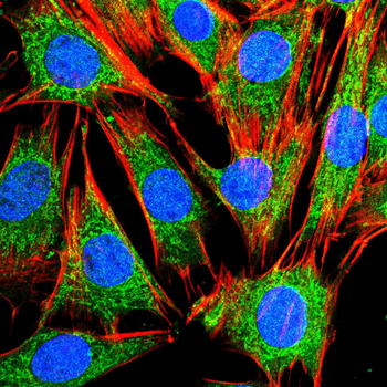 MMP1 Antibody