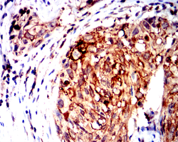MMP1 Antibody