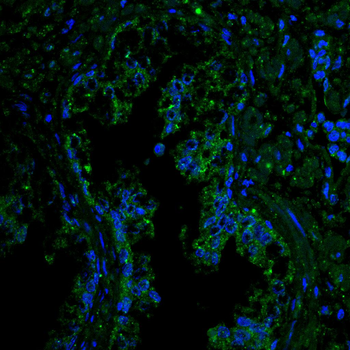 MMP1 Antibody