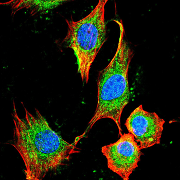 LDHA Antibody