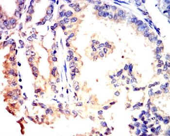 LDHA Antibody