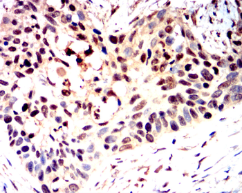 LDHA Antibody