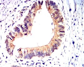 LDHA Antibody