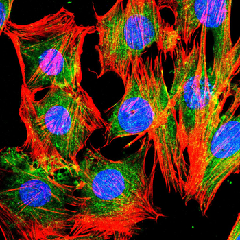PTPRB Antibody