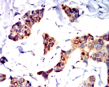 PTPRB Antibody
