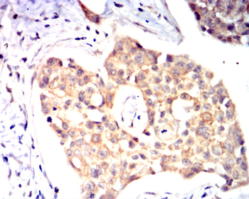 PTPRB Antibody