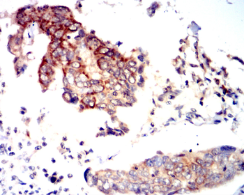 PTPRB Antibody