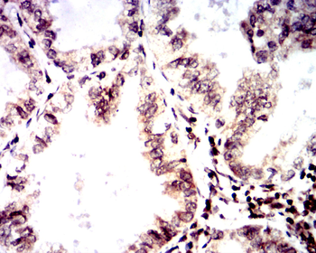 CCNA2 Antibody