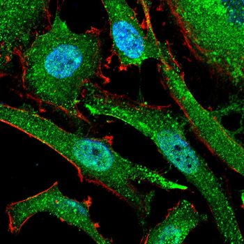 GSTP1 Antibody