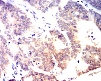 GSTP1 Antibody