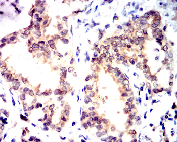 GSTP1 Antibody