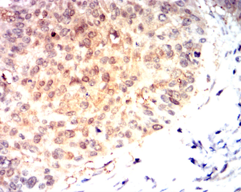GSTP1 Antibody