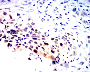 GSTP1 Antibody