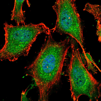 Hemgglutinin Gene Antibody