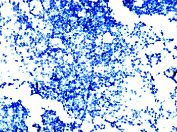 Hemgglutinin Gene Antibody
