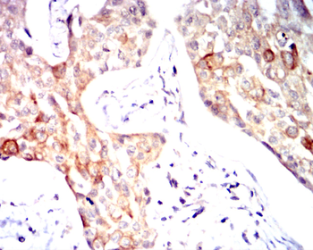 ATF6 Antibody