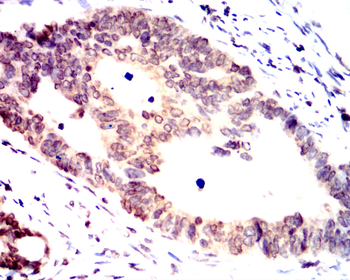 ATF6 Antibody