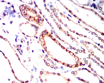 ATF6 Antibody