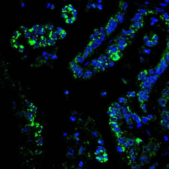 ATF6 Antibody