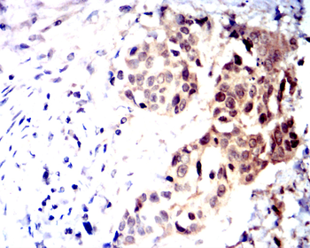 PMS2 Antibody