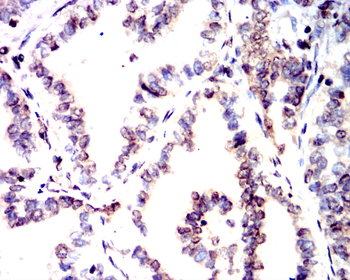 PMS2 Antibody