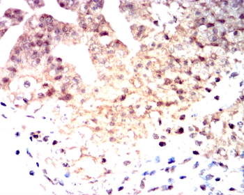 PMS2 Antibody