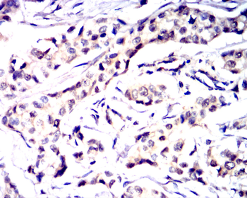 ATF4 Antibody