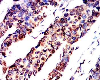 ATF4 Antibody