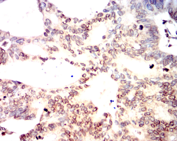 ATF4 Antibody