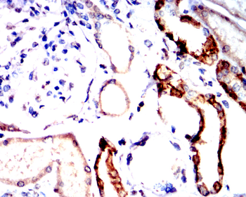 ATF4 Antibody